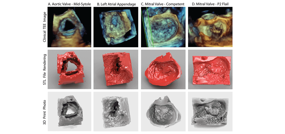 unlocking-vendor-specific-tags-three-dimensional-printing-echocardiography-data-sets-2